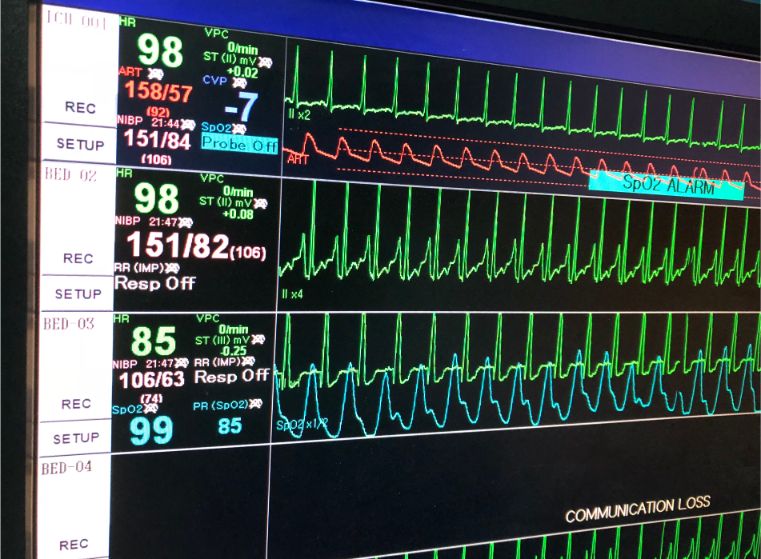 Telemetry